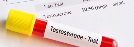 בדיקת טסטוסטרון (Testosteron) - תמונה